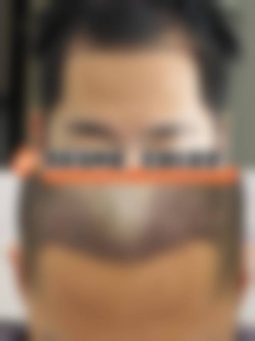 六、北京丽格稙云医疗美容诊所怎么预约：