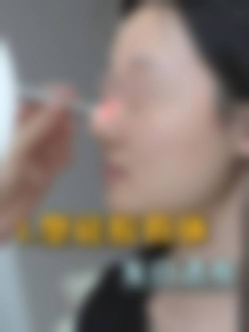 五、安徽医 科 大学第二附属医院整形美容中 心实例