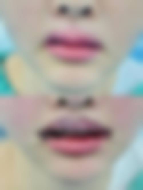 四、重庆万悦整形医院开展的主要项目和特色项目：