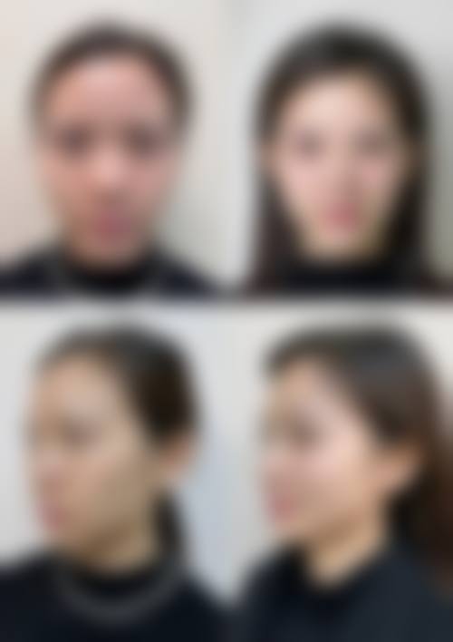 六、韩国345整形外科怎么预约：