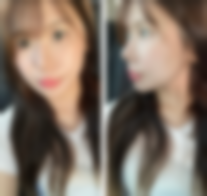 五、南昌艳丽医疗美容门诊部实例