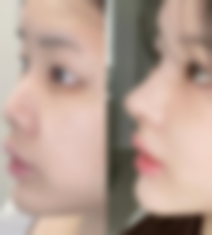 七、南昌艳丽医疗美容门诊部价格表：（仅供参考）