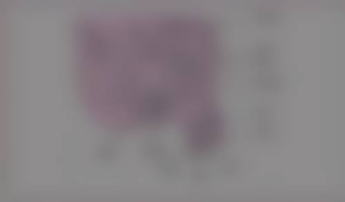 精细抽脂塑造流畅眼睑线条的优势