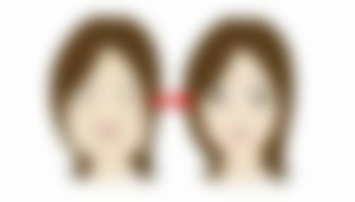 割双眼皮究竟要不要抽脂？看眼部情况，精准抽脂助你塑造流畅眼睑线条