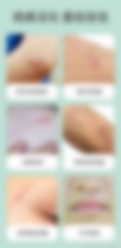 潘姝医生口碑和评价