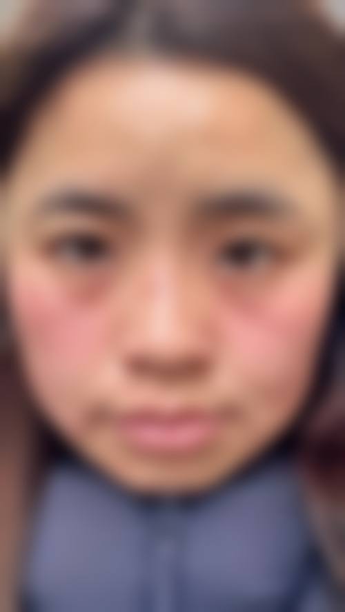 辛杰医生项目价格表参考