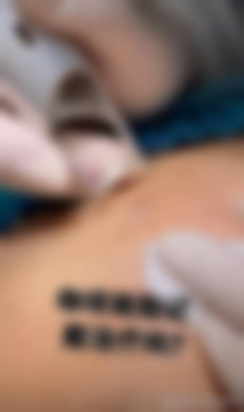 辛杰医生祛斑怎么样可靠吗?