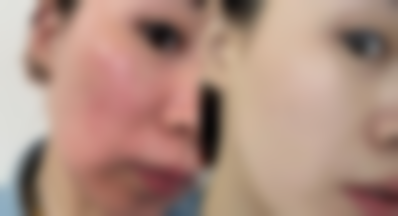 六、乌鲁木齐艺颜智美整形医院价格表：（仅供参考）