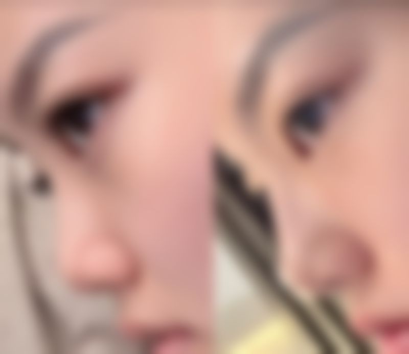 七、韩国CHANNEL综合整形外科医院价格表：（仅供参考）