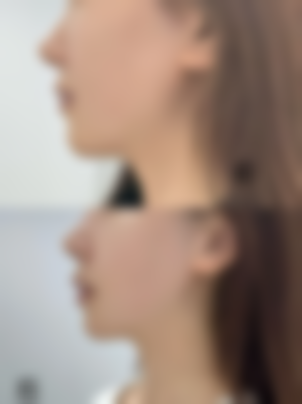 五、延世De:AGE医院怎么预约：