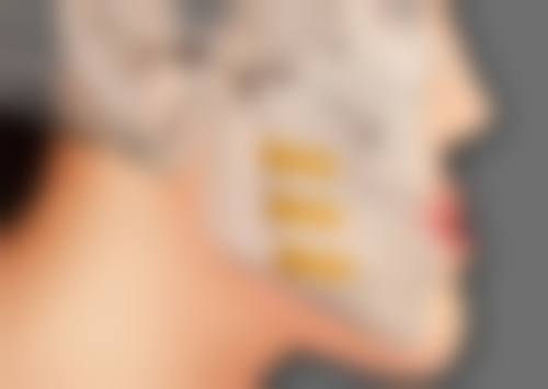 华美面部吸脂修复要多久？不同阶段的修复情况