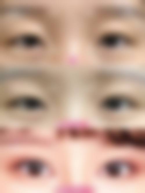 五、丹阳丽身华美医疗美容诊所实例