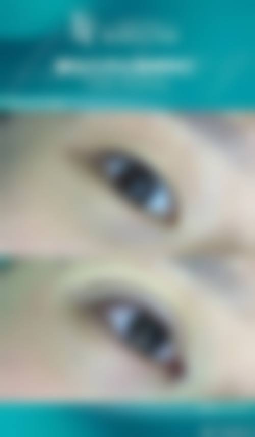 汪锦伦医生怎么预约?