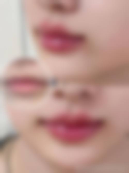 七、南京奥利维亚整形医院价格表：（仅供参考）