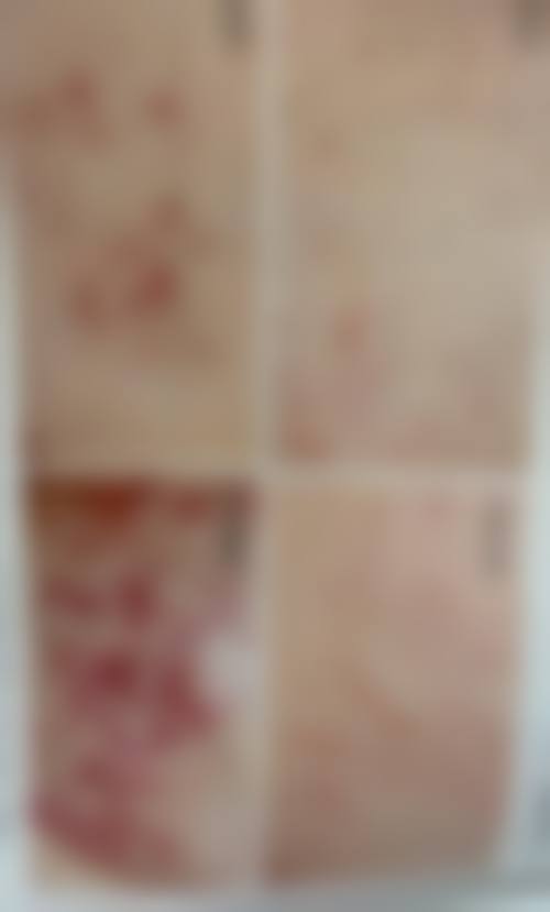 六、深圳市第二人民医院整形烧伤科怎么预约: