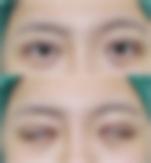 七、襄阳屠明军 医疗美容门诊部价格表:(仅供参考)