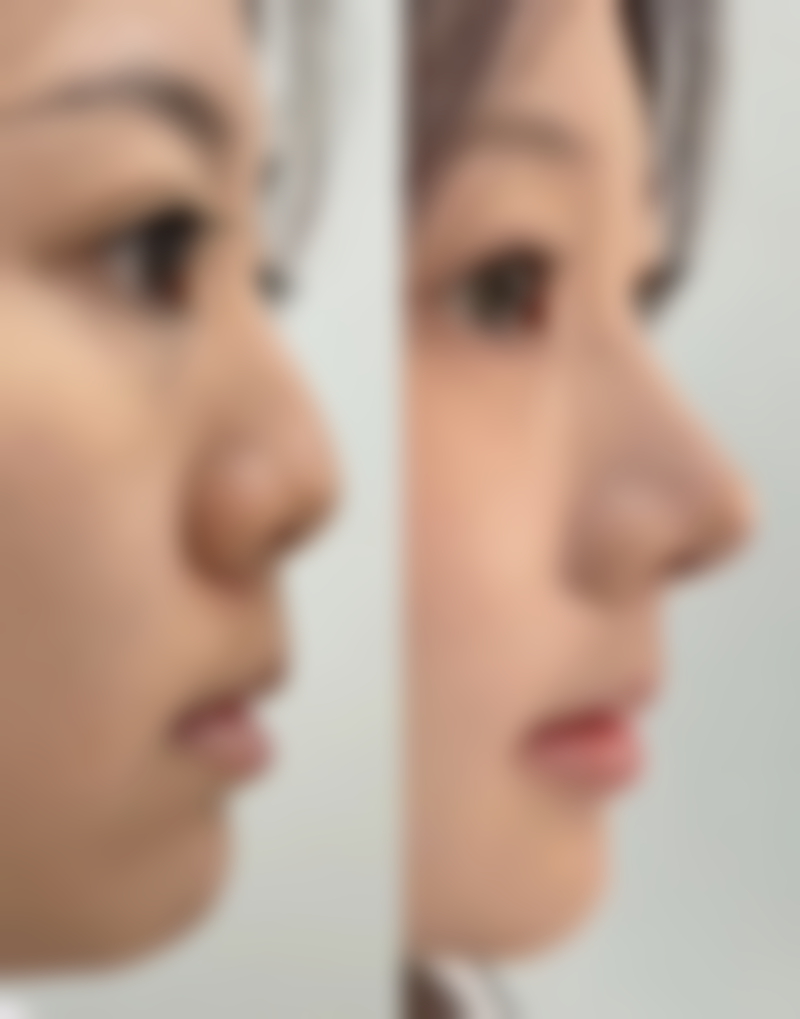 五、襄阳屠明军 医疗美容门诊部实例