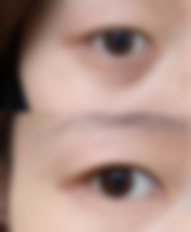 七、深圳市第二人民医院整形烧伤科价格表:(仅供参考)