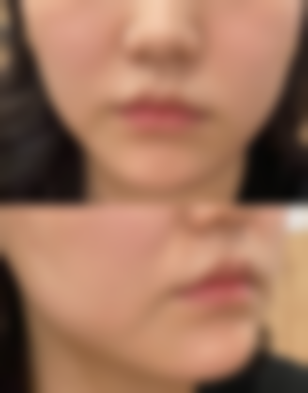 七、芜湖美人鱼医疗美容（陈伟中医疗美容）价格表：（仅供参考）