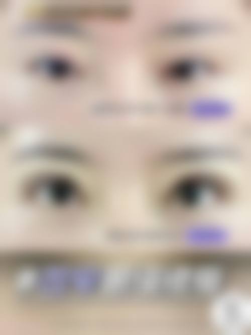 七、成都高新沁熹整形医院价格表：（仅供参考）