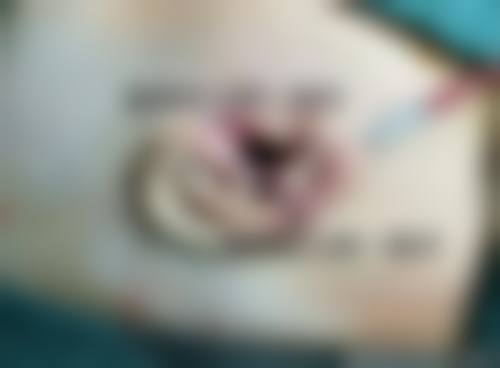 八、福建省立医院整形外科真实的顾客评价如下：