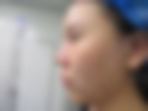 七、福建省立医院整形外科价格表：（仅供参考）