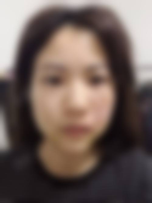 三、福建省立医院整形外科医生介绍: