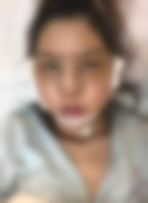 六、福建省立医院整形外科怎么预约：