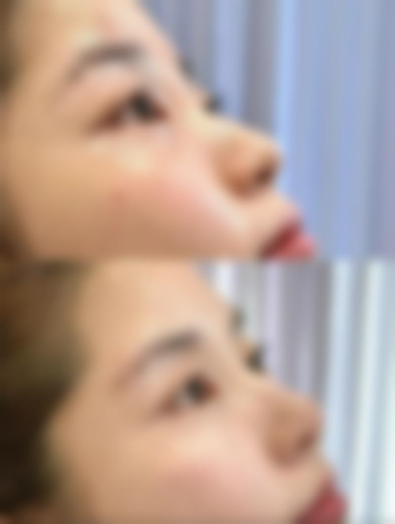 皮肤留疤怎么办？治疗过程中的注意事项