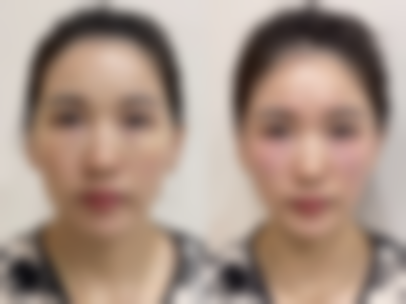 八、合肥美利来整形医院真实的顾客评价如下：