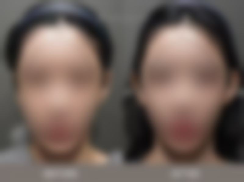 室内装修双眼皮吊顶这样做：打造理想双眼皮造型有诀窍