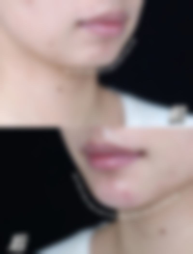 五、福建省立医院整形外科实例