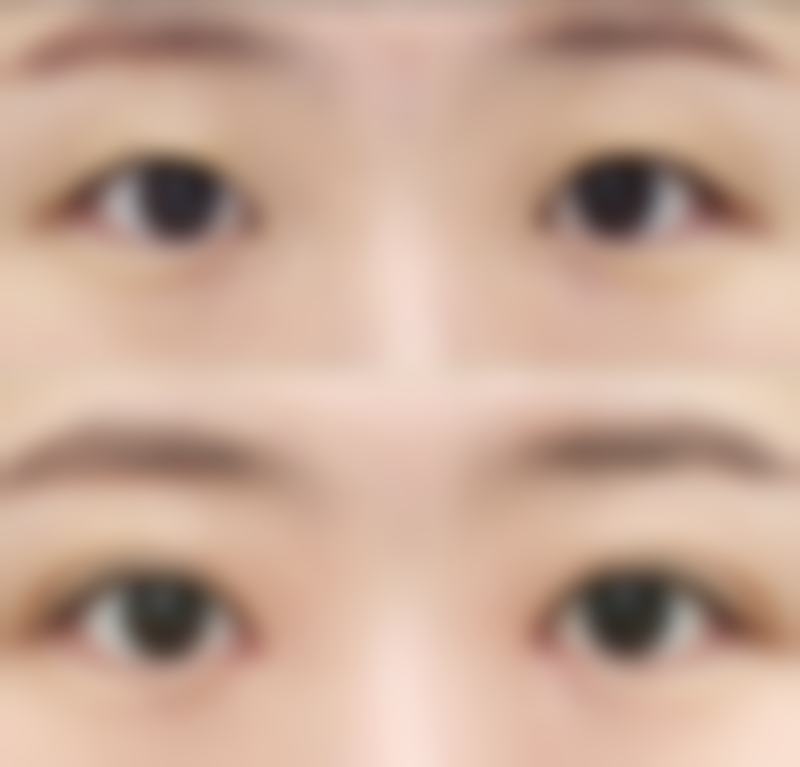 矫立仁医生项目价格表参考