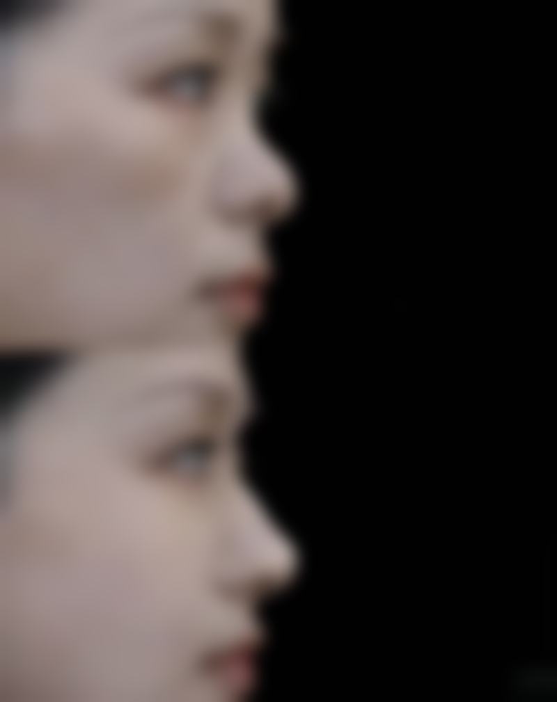 五、日本MEGA美容整形外科实例