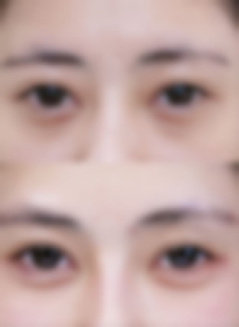 八、日本MEGA美容整形外科真实的顾客评价如下：