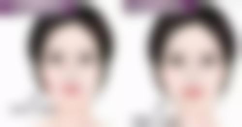 丰太阳穴有哪些风险？详解自体脂肪与玻尿酸填充潜在问题及规避方法 