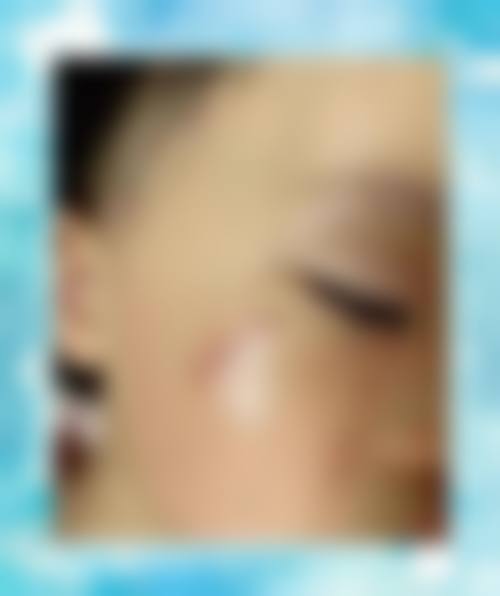 梁志刚医生项目价格表参考