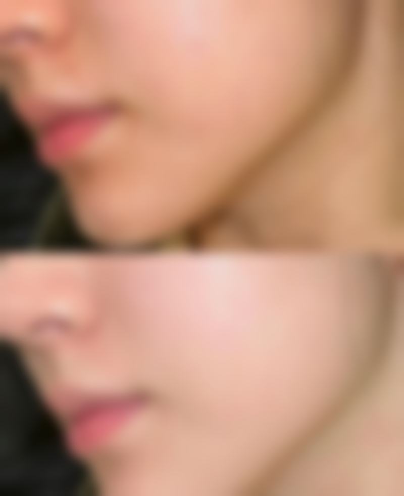 八、襄阳爱尚美医疗美容医院真实的顾客评价如下：