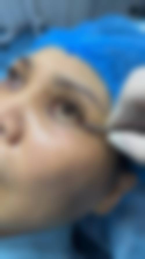 五、北京予馨美医疗美容实例