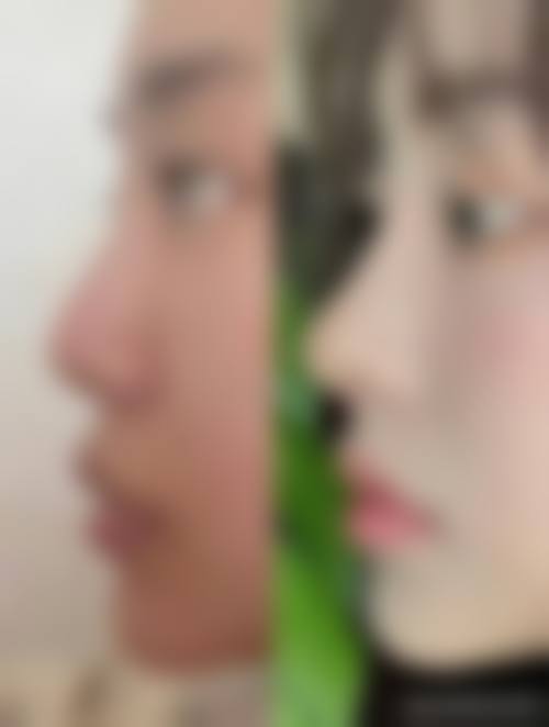 七、西安高岚医疗美容诊所价格表：（仅供参考）