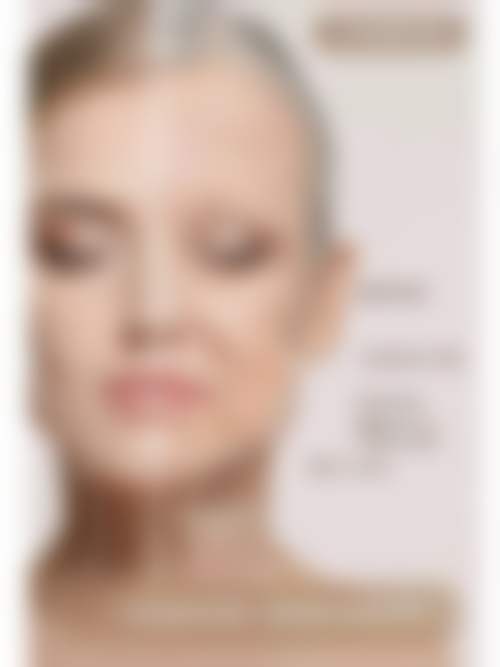 杨小刚医生玻尿酸注射实例