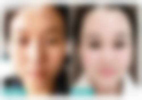 六、西安高岚医疗美容诊所怎么预约：