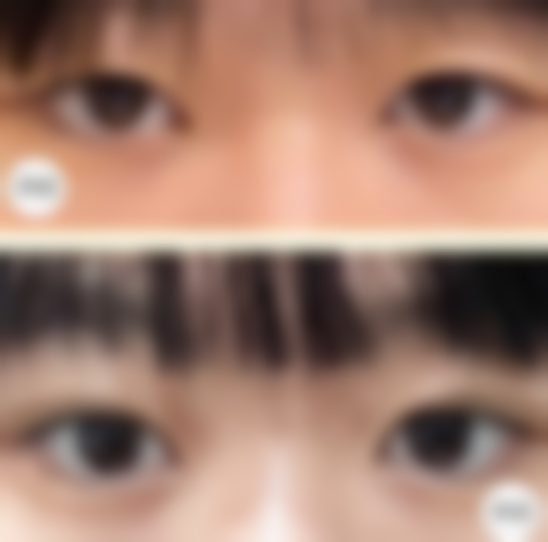 七、西安丽薇达诊所价格表：（仅供参考）