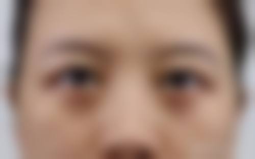 五、福州米兰医学美容门诊部实例