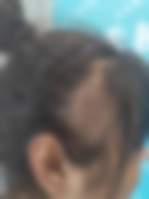 牛光华医生实例