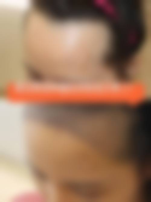 牛光华医生项目价格表参考