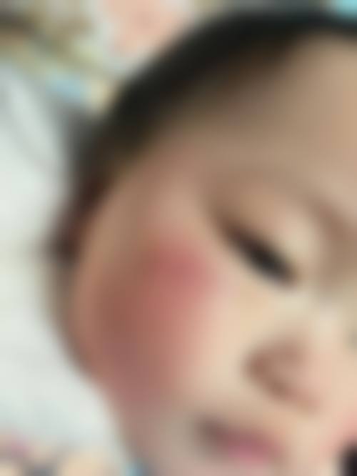 六、复旦大学附属华 山医院整形外科怎么预约：