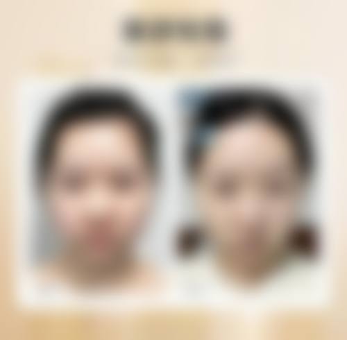 五、复旦大学附属华 山医院整形外科实例