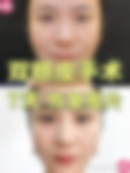 八、上海颜范医疗美容门诊部真实的顾客评价如下：