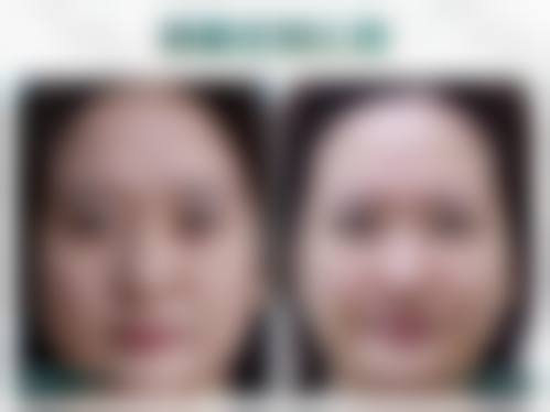 二、常熟市第二人民医院整形美容科正规吗?来看看医院资质: